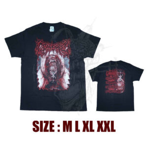 TS - CEPHALOTRIPSY - Crushing The Head Of A Fetus In The Womb