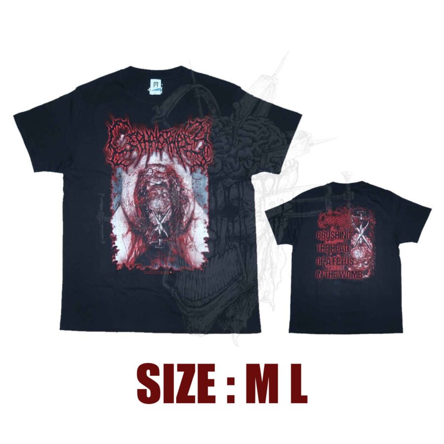 TS - CEPHALOTRIPSY - Crushing The Head Of A Fetus In The Womb