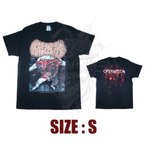 TS - PAEDIATRICIAN - Operation