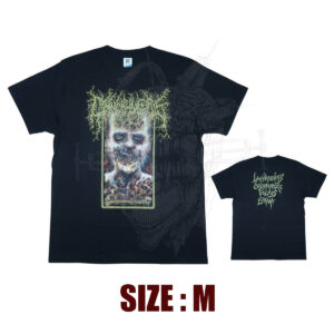 TS - CANCRUM ORIS - Limpheadenitis