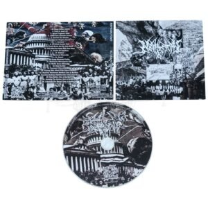 CD - NEPHRECTOMY - El Chapo Gonzo