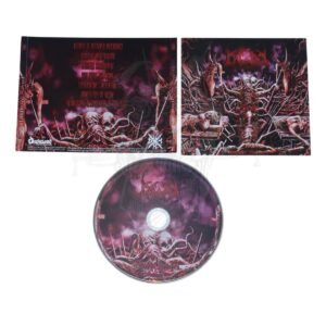 CD - BIGOT - Interrupted Pregnancy