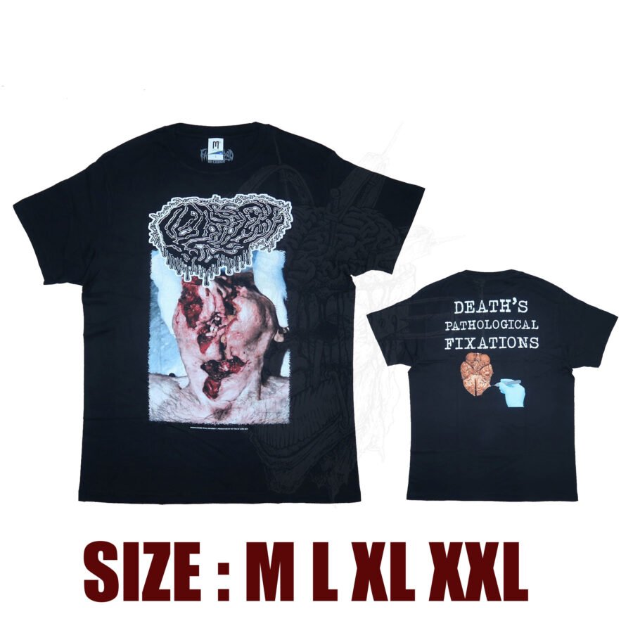 T-SHIRT - FETAL DEFORMITY - Death's Pathological Fixations