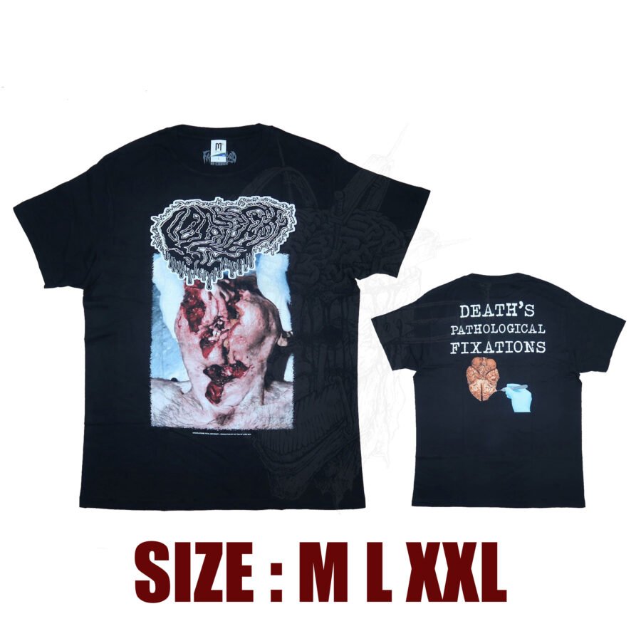 T-SHIRT - FETAL DEFORMITY - Death's Pathological Fixations