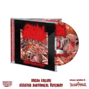 FLAG - ORGAN FAILURE - Assisted Anatomical Butchery