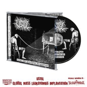 CD - USTEL - Global mass leukotomies implantation