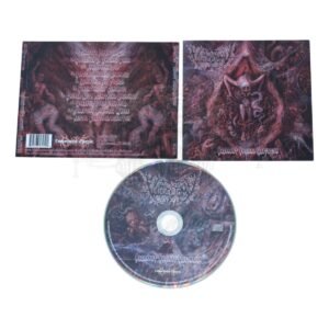 CD - VULVECTOMY - Aberrant Vaginal Gestation