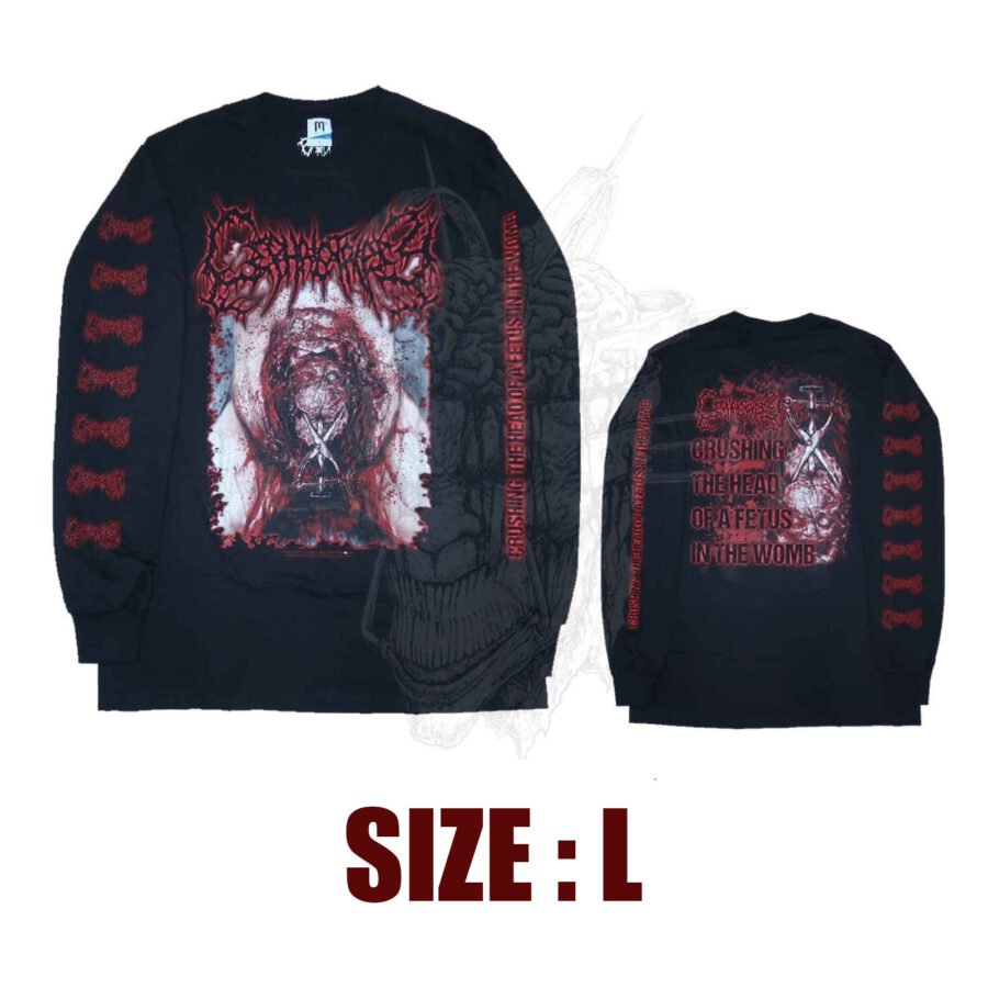 LONGS LEEVE - CEPHALOTRIPSY - Crushing The Head Of A Fetus In The Womb